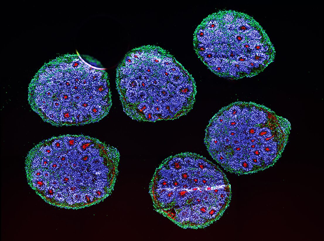 Hình ảnh organoid dưới kính hiển vi