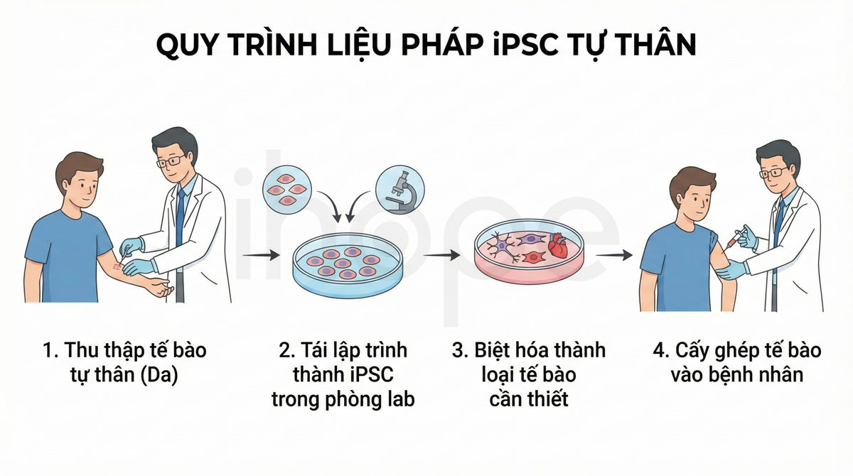 Quá trình thực hiện liệu pháp iPSC tự thân