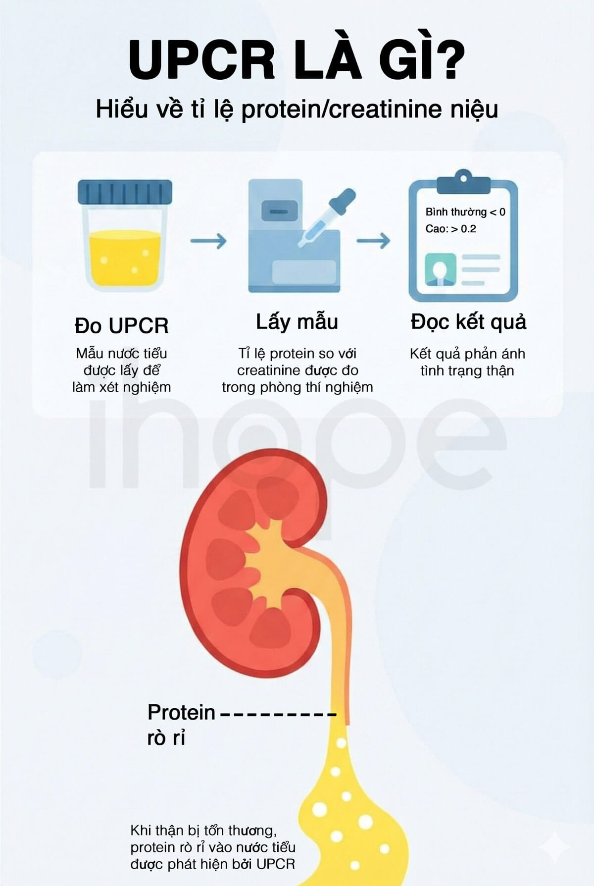 Phương pháp đo tỉ lệ protein/creatinine trong nước tiểu