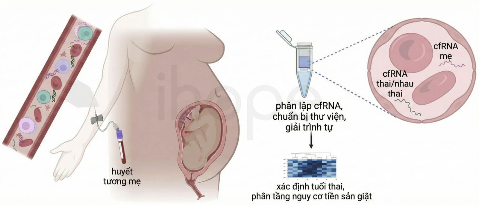 cfRNA là biomarker tiềm năng cho sàng lọc sớm tiền sản giật