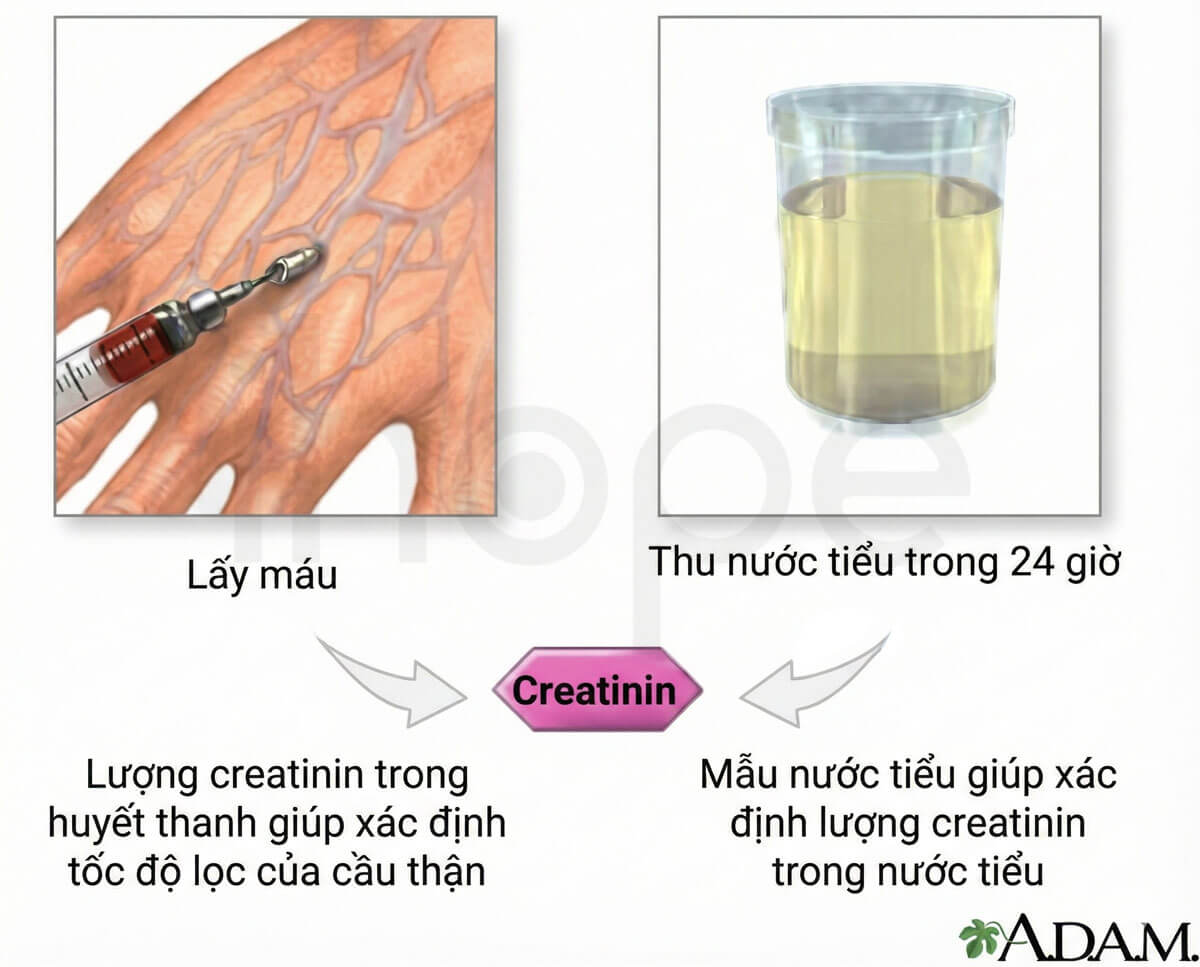 Xác định nồng độ creatinin trong huyết thanh và nước tiểu