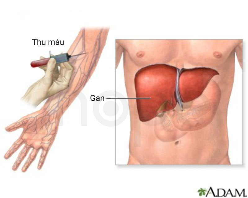 Danh gia chuc nang gan thong qua xet nghiem mau