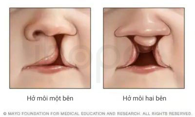 Ho moi