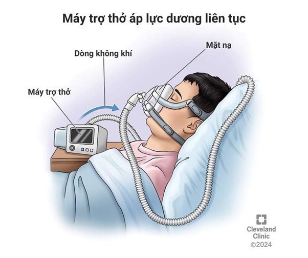 May tro tho ap luc duong