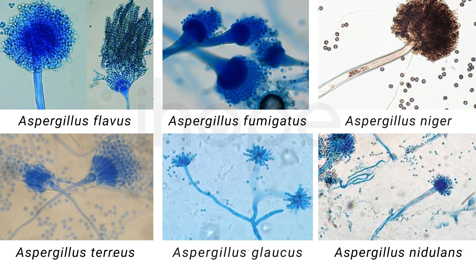 Mot so loai nam Aspergillus quan sat duoi kinh hien vi