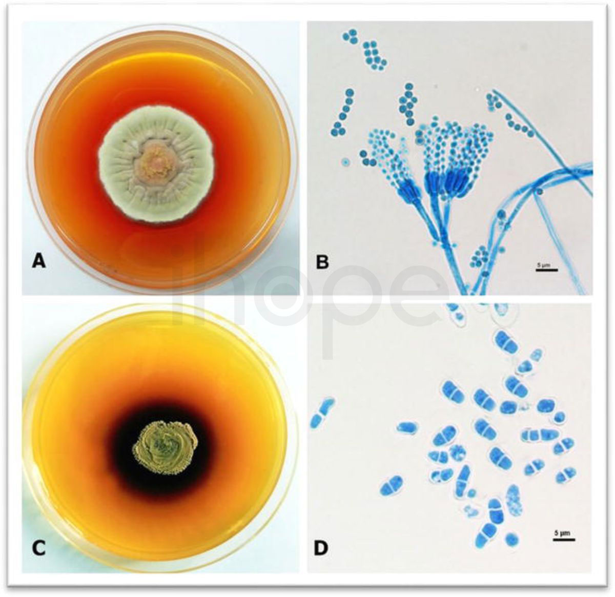 Nam Talaromyces marneffei