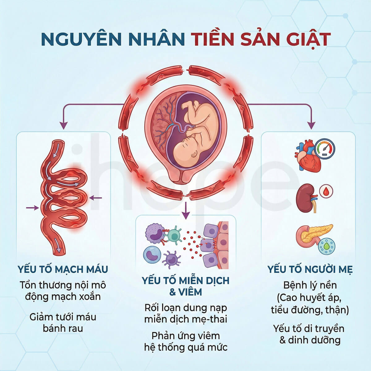 Nguyên nhân gây ra tiền sản giật