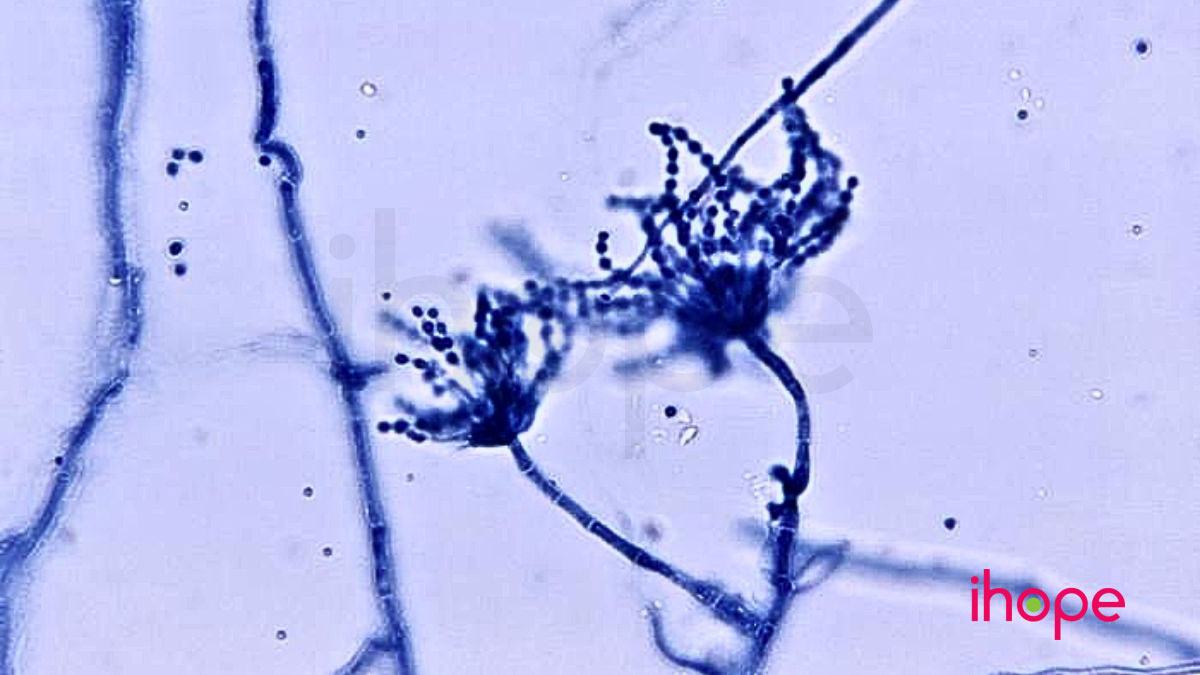 Nhiem nam Talaromyces marneffei cover
