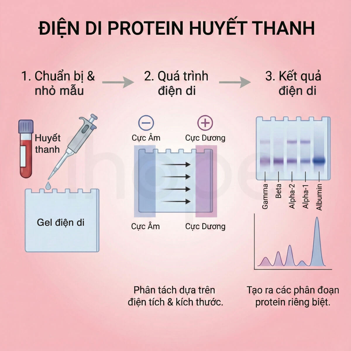 Quá trình điện di protein