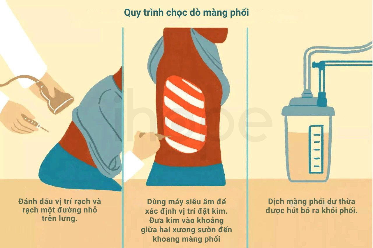 Quy trinh choc do mang phoi