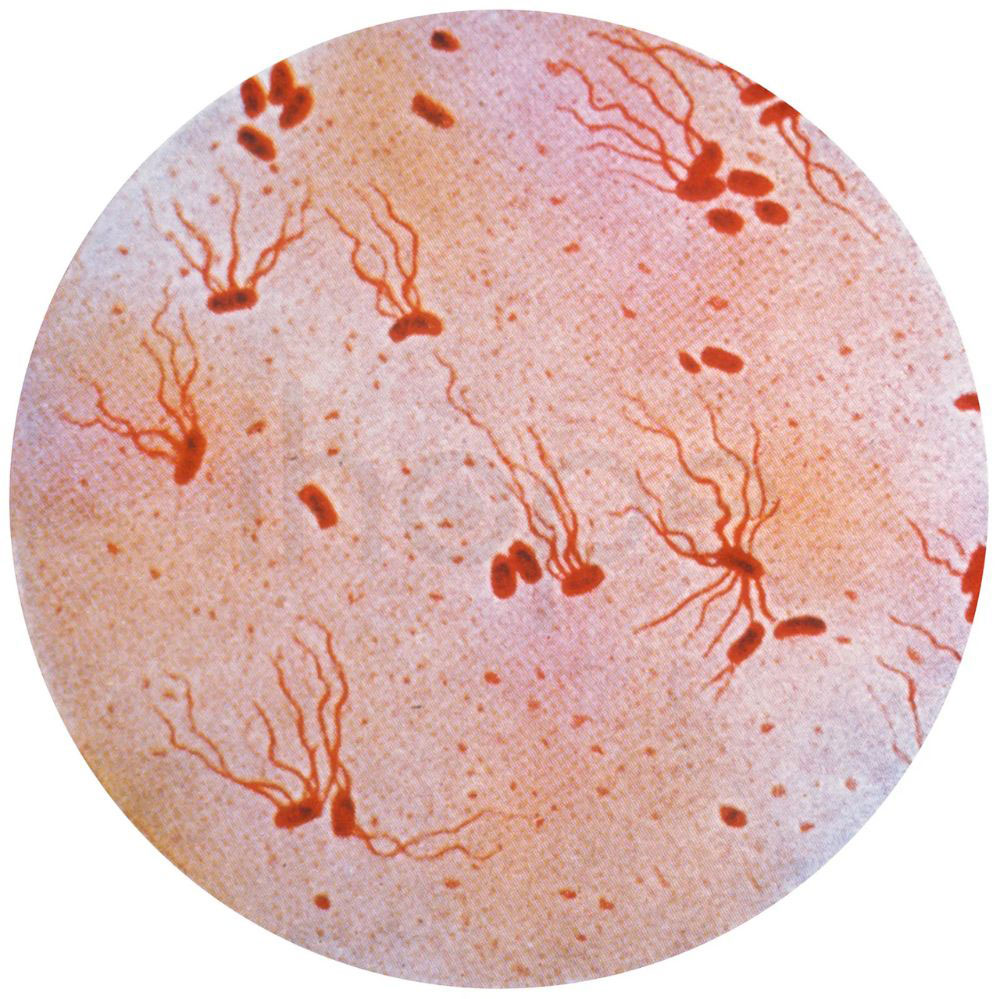 Vi khuan Salmonella Typhi