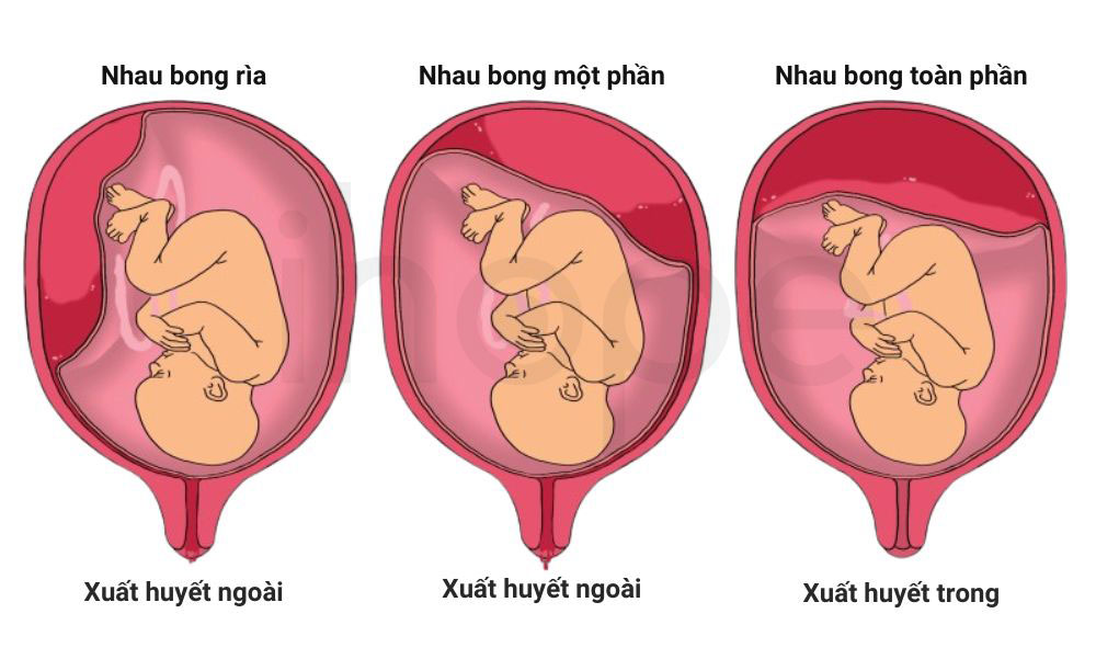 Cac dang nhau bong non