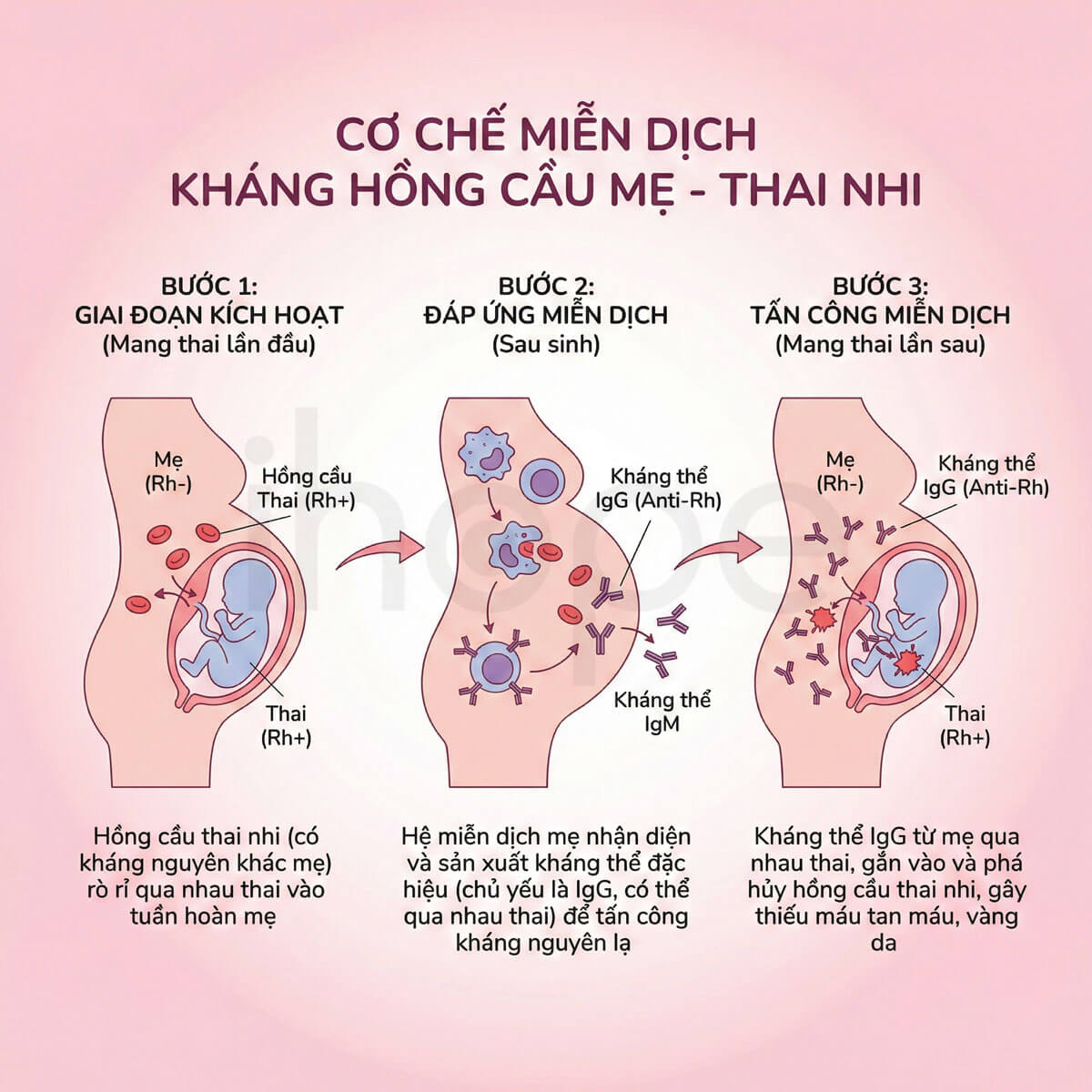 Cơ chế miễn dịch kháng hồng cầu mẹ-thai nhi
