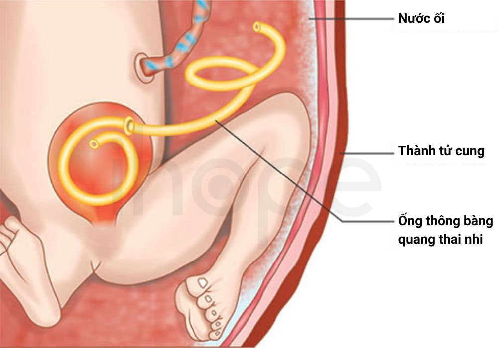 Dat ong thong thai nhi