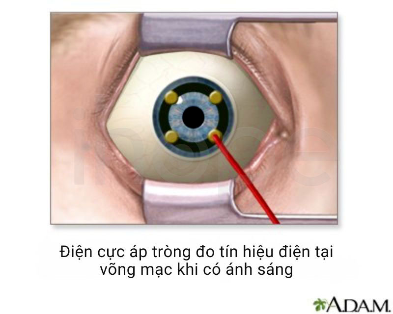 Dien co mat