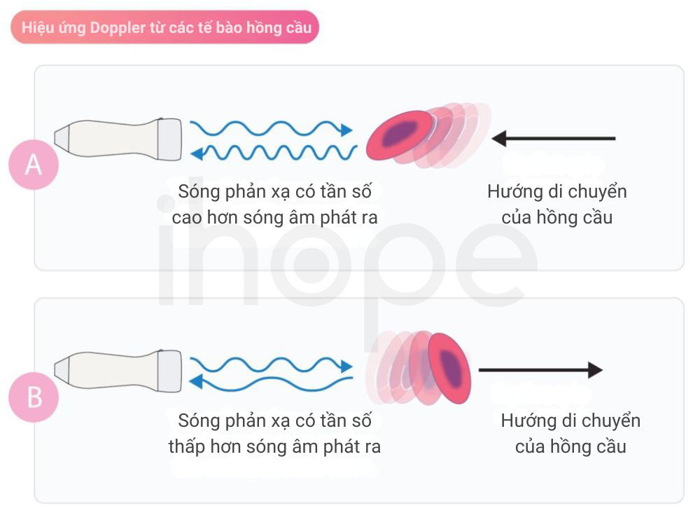 Hieu ung Doppler te bao hong cau