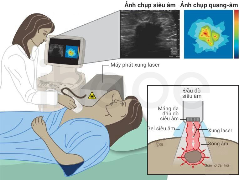 Ky thuat chup anh quang am