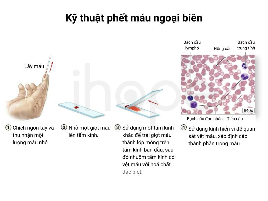 Ky thuat phet mau ngoai bien