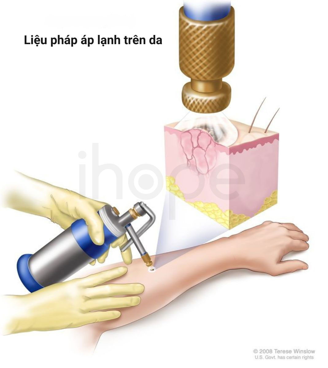 Lieu phap ap lanh tren da