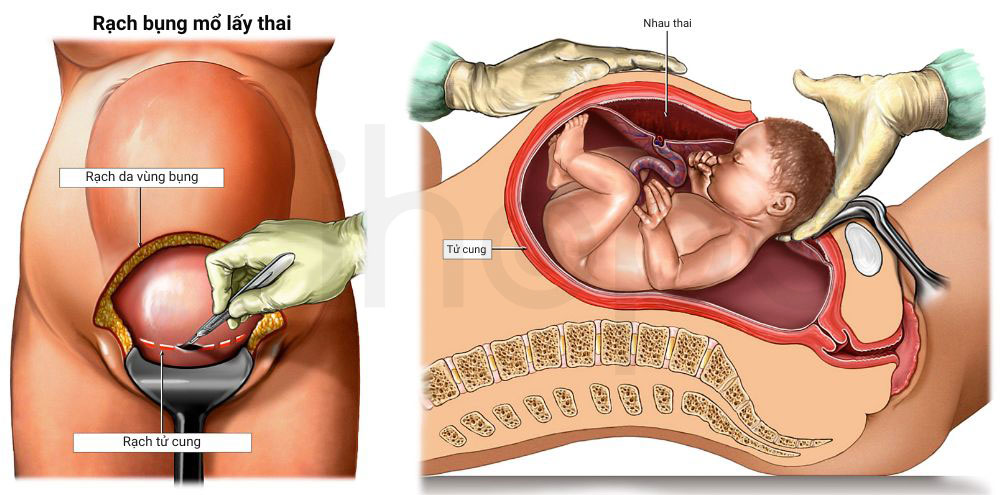 Mo lay thai