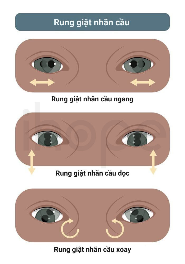 Rung giat nhan cau