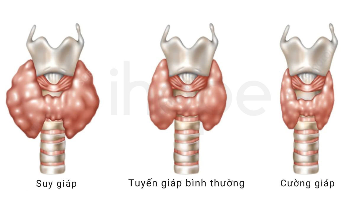 Suy giap va cuong giap