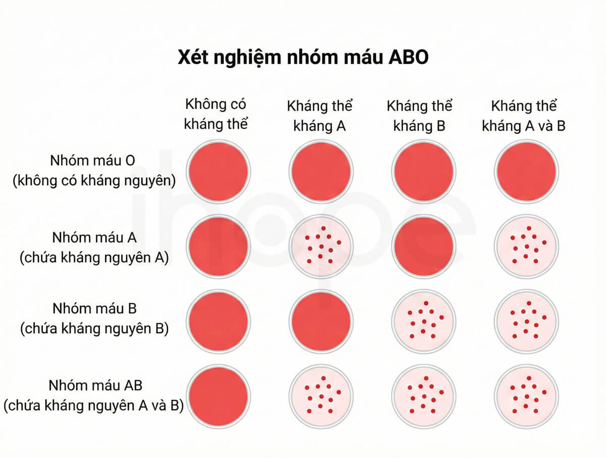 Xét nghiệm nhóm máu hệ ABO