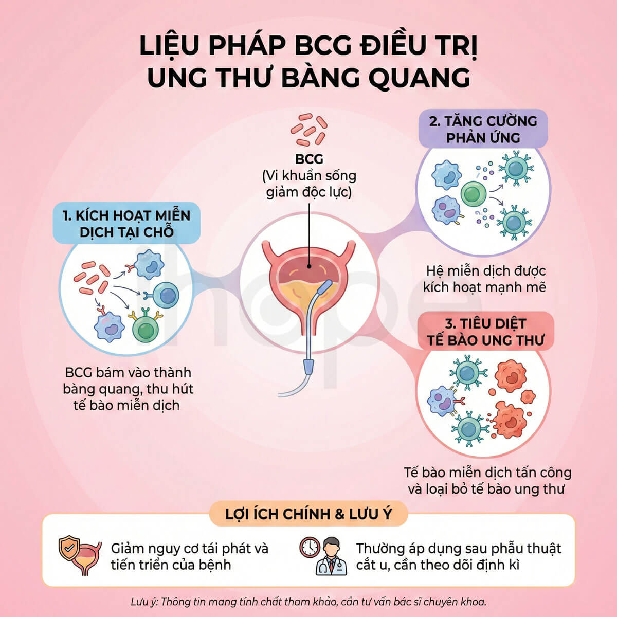 Liệu pháp BCG điều trị ung thư bàng quang