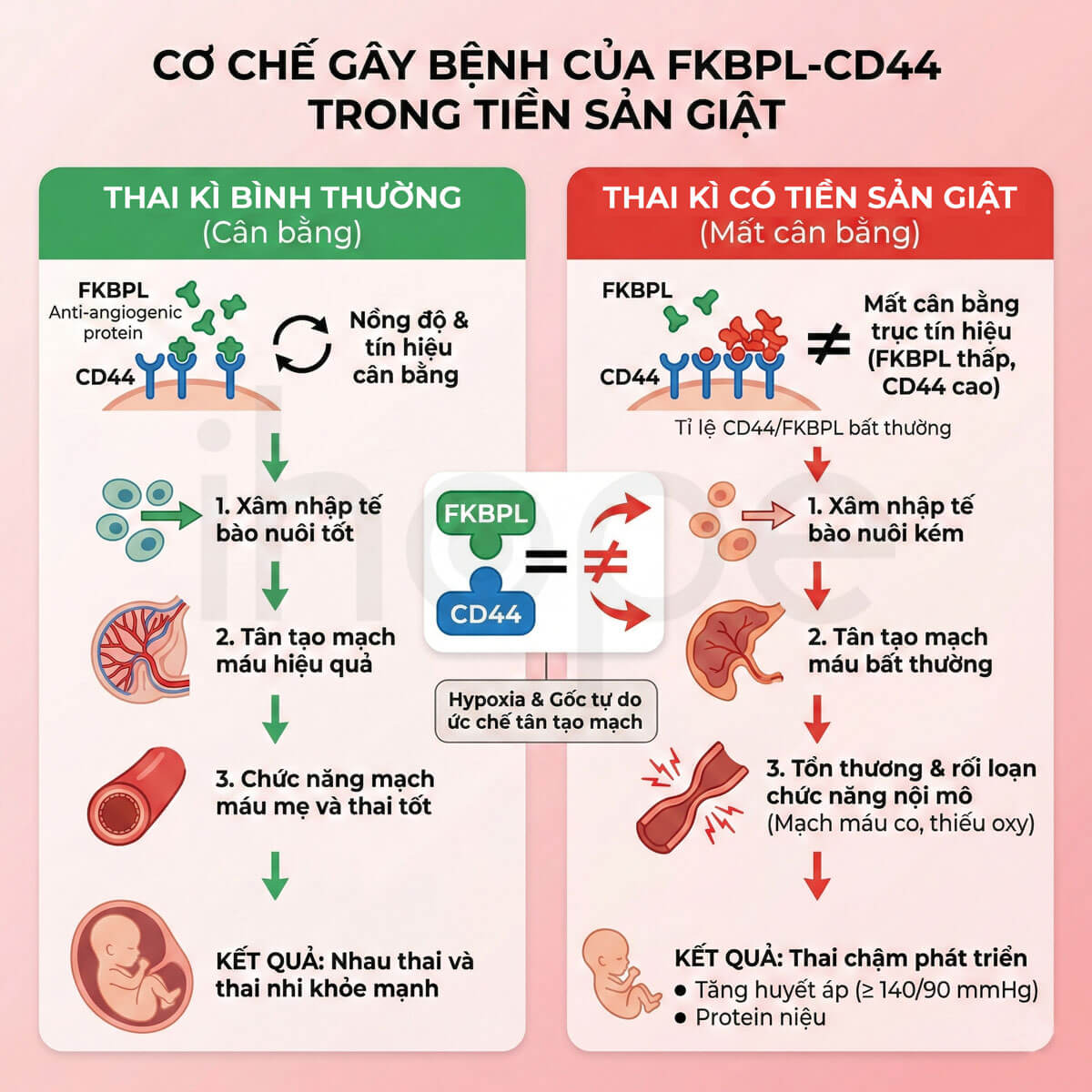 Con đường FKBPL-CD44 trong cơ chế bệnh sinh của tiền sản giật