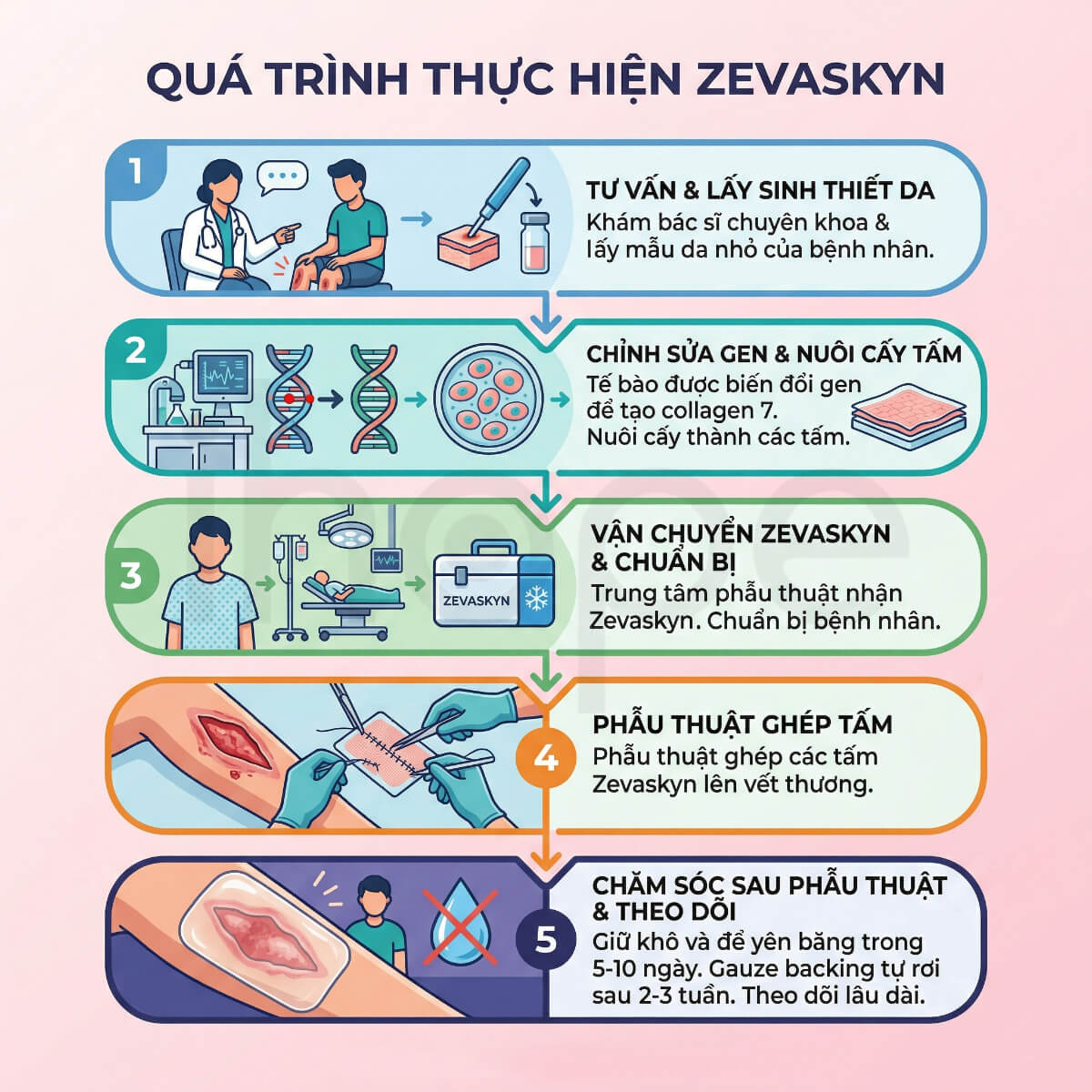Quá trình thực hiện liệu pháp Zevalskyn