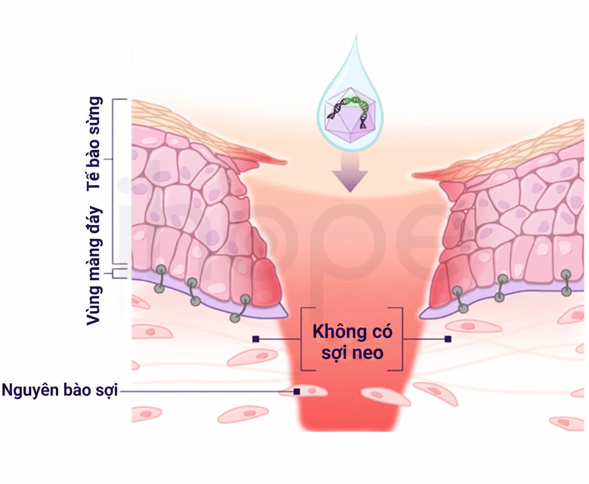 Cơ chế hoạt động của liệu pháp Vyjuvek