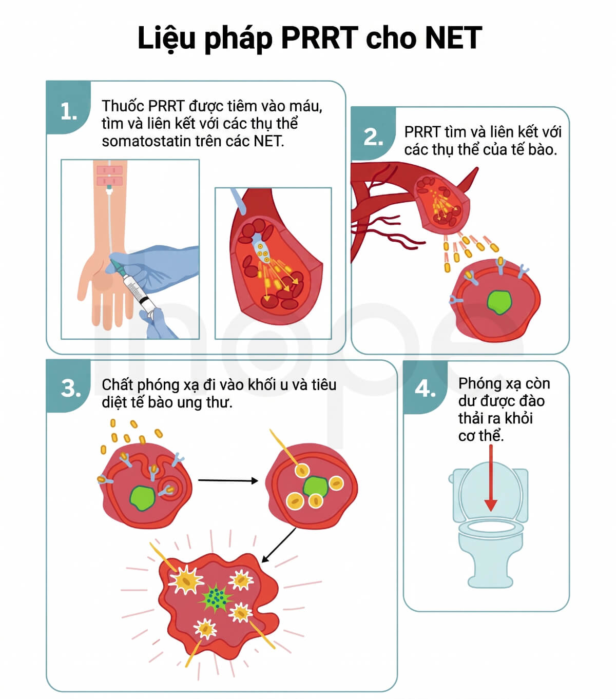 Quá trình điều trị bằng liệu pháp xạ trí gắn thụ thể peptide